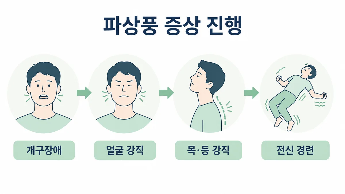 파상풍 증상 진행 단계 도표 — 개구장애에서 시작해 얼굴 근육 강직, 목·등 강직, 전신 경련으로 진행
