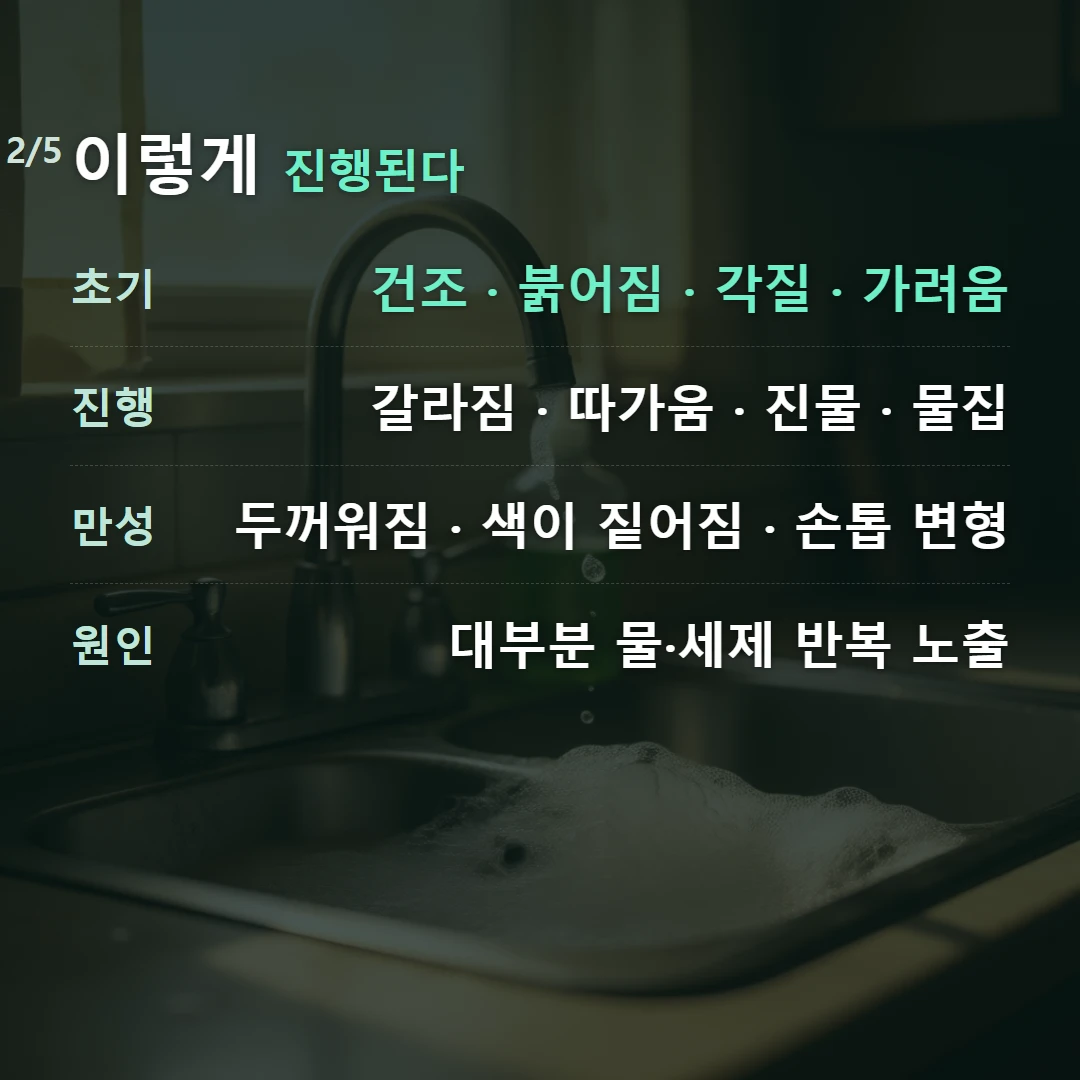 이렇게 진행된다 — 초기 건조 · 붉어짐 · 각질 · 가려움, 진행 갈라짐 · 따가움 · 진물 · 물집, 만성 두꺼워짐 · 색이 짙어짐 · 손톱 변형, 원인 대부분 물·세제 반복 노출
