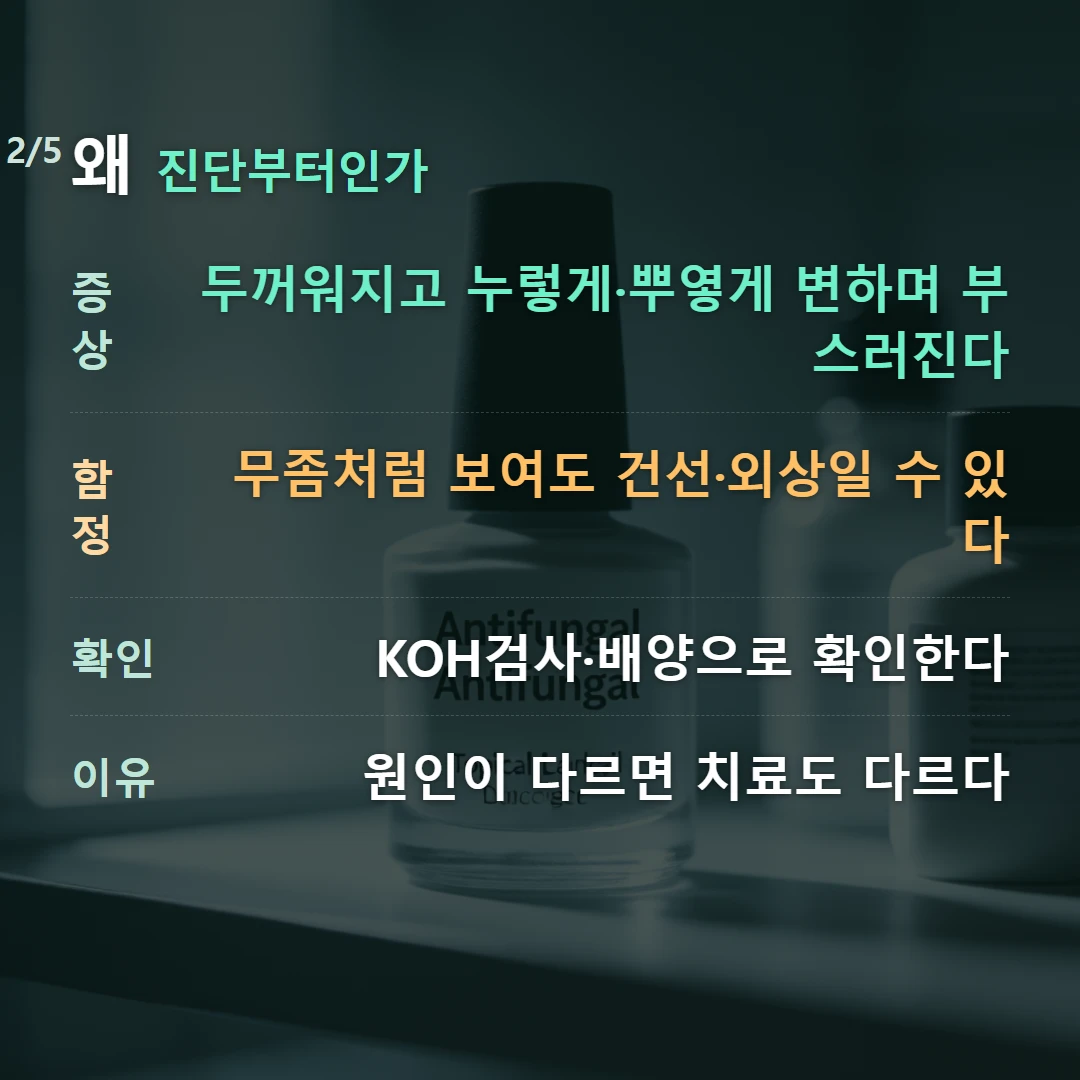 왜 진단부터인가 — 증상 두꺼워지고 누렇게·뿌옇게 변하며 부스러진다, 함정 무좀처럼 보여도 건선·외상일 수 있다, 확인 KOH검사·배양으로 확인한다, 이유 원인이 다르면 치료도 다르다